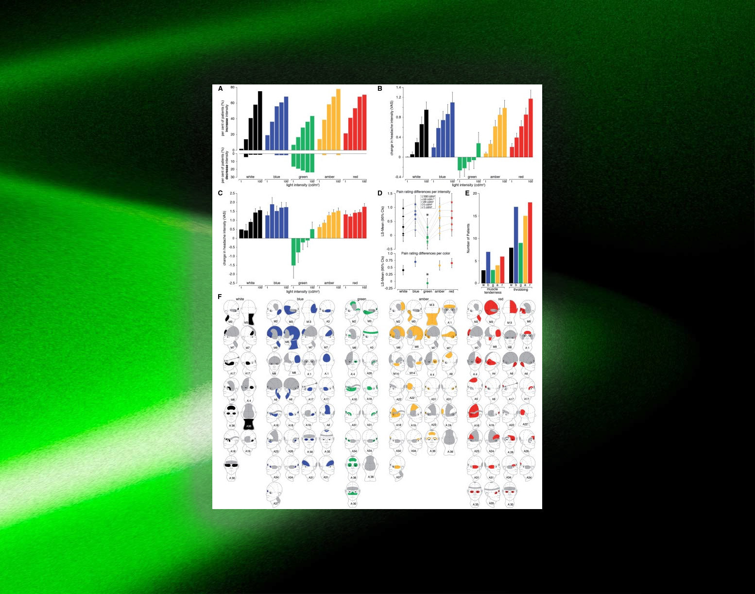 Charts and graphics from a research paper about migraine photophobia.
