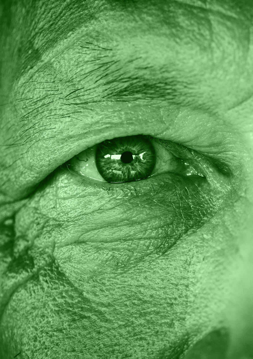 The eye of an older gentleman as seen through narrow band green light lenses.